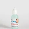 Acné de La Fé | Solución para el cuidado de la piel | 60 ml